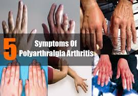 Pin On Arthritis