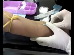 Image result for The correct method of taking blood from  the arm