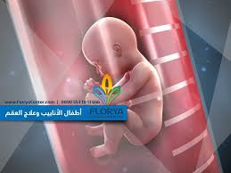 أطفال الأنابيب التلقيح الصناعي علاج العقم مركز فلوريا Florya