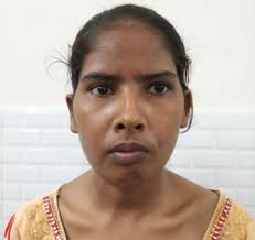 Brown Tumours of Maxilla and Mandible as Index Presentaion of Primary  Hyperparathyroidism