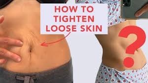 Jun 19, 2019 · 7 tips for firming loose skin after pregnancy 1. How To Tighten Loose Skin How I M Tightening My Loose Skin After Pregnancy Youtube