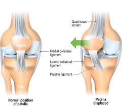 Ligaments are fibrous bands or sheets of connective tissue linking two or more bones, cartilages, or structures together. Anatomy Of Knee