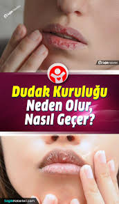 Dudak Kurulugu Neden Olur Nasil Gecer Cilt Bakimi 2020 Saglik Cilt Bakimi Saglik Urunleri