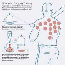 Cupping Points Chart Pdf 2019 I 2020 Reflexologi Spa Halsa