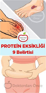 Karin Duzlestirmek Icin 8 Ipucu Doktordan Once Protein Deficiency Symptoms Health Protein
