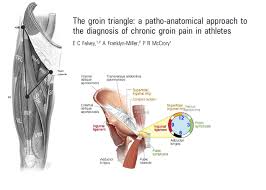 Diagram of groin area / groin muscles diagram koibana info. Hip Athletic Groin Pain Part 1 Rayner Smale