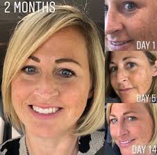 It's time to refresh and rejuvenate your skin! 🖤 Did you know that  @Biothermhomme Force Supreme range is clinically proven to protect the skin  against daily aggressors that age the skin? When