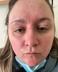 Erin🎀 (@chronicallyerin) • Instagram photos and videos