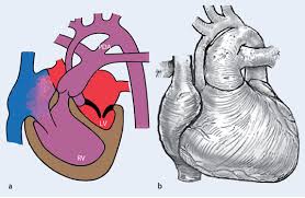Hz) is the derived unit of frequency in the international system of units (si) and is defined as one cycle per second. Das Zyanotische Kind Mit Kardialer Erkrankung Im Notfalldienst Springerlink