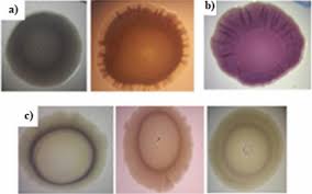 A number of its serovars are serious human pathogens. Biofilm Formation By Salmonella Enterica Strains Springerlink