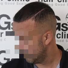 LGS Hair Clinic España added a...