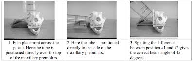 X Ray Positioning Chart With Images Ray Positioning By Konica