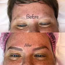 Microblading Permanent Makeup Removal Brow Envy By Shambree