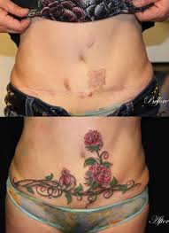 I believe it could cover it up, its also an option for those who get surgery and wanna hide the scars. 12 Coolest Tattoos Covering Scars Tattoos Over Scars Tattoos To Cover Scars Oddee