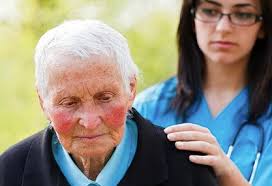 Post-Stroke Depression