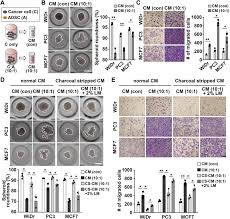 We would like to show you a description here but the site won't allow us. Metastasis On A Chip Reveals Adipocyte Derived Lipids Trigger Cancer Cell Migration Via Hif 1a Activation In Cancer Cells Sciencedirect