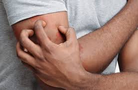 Signs That Itch is a Medical Problem – Cleveland Clinic