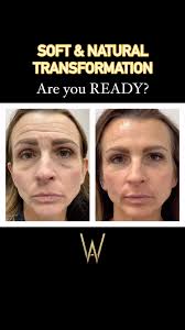 It’s not to late, we have many options at Wise Aesthetics to take off a few  years. “You, only better”, 𝚆𝚒𝚜𝚎 𝙰𝚎𝚜𝚝𝚑𝚎𝚝𝚒𝚌𝚜, 🏠2325 Pointe  Parkway 110, 𝙲𝚊𝚛𝚖𝚎𝚕, 𝙸𝙽, ☎️317-569-6448, 🥼𝙲𝚛𝚒𝚜𝚜𝚢  𝚆𝚒𝚜𝚎𝚖𝚊𝚗 NP-C, ...