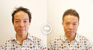 前編 男の薄毛を自然に隠せる髪型22選 o字m字などハゲを熟知した美容師のヘアカタログ aga対応髪型 22番目の画像 薄毛ヘアスタイル 薄毛 はげ 髪型