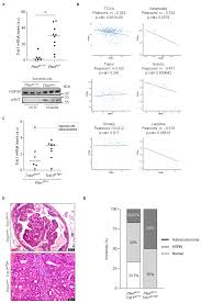 The american cancer society provides detailed information on prostate cancer and its treatment. Cancers Free Full Text Genomic And Functional Regulation Of Trib1 Contributes To Prostate Cancer Pathogenesis