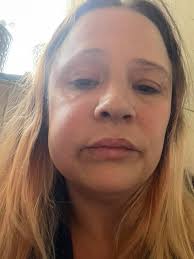 Sat here with cellulitis so can't eat hard food does anyone have any soft  food ideas that arnt soup please xx edit , thank you all for your kind  comments an amazing