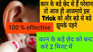 Today, i will be sharing with you some home remedies that you can follow in order to reduce ear hole size naturally without any surgery. How To Reduce Ear Hole Size Naturally At Home à¤• à¤¨ à¤• à¤› à¤¦ à¤• à¤› à¤Ÿ à¤• à¤¸ à¤•à¤° Youtube