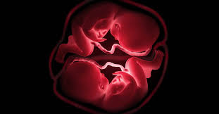 Pregnancy usually occurs by sexual intercourse, but can occur through assisted reproductive technology procedures. 24 Signs And Symptoms Of Twin Pregnancy