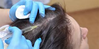 More extensive fue treatments including 3000 hair grafts might total closer to rs 1,40,000. What Is The Cost Of Prp Hair Loss Treatment In Hyderabad What About The Location Quora