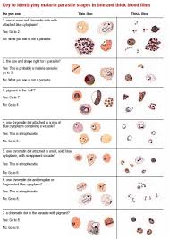 Malaria has a disproportionately negative impact on human health because its causal protozoan parasites are adept at changing their genomes to evade antimalarial drugs and the human immune system. Key To Identifying Malaria Parasite Ethiopian Medical Laboratory Scientists Emls Facebook