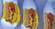 12 Choses Qui Arrivent A Votre Corps L Orsque Vous Mangez 3 Dattes Par Jour Perdre La Graisse Abdominale Graisse Abdominale Sante