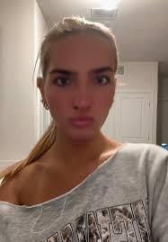 brand new nose #rhinoplasty #nosejob