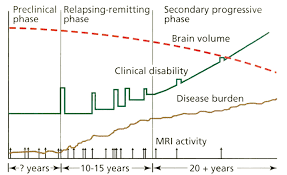 multiple sclerosis