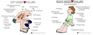 Left And Right Sided Heart Failure Heart Failure Nursing Right Sided Heart Failure Cardiac Nursing
