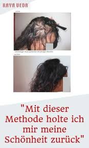 vorher nachher bilder diffuser kreisrunder haarausfall bei frauen haarausfallfrauen haarausf haarausfall haarausfall frauen kreisrunder haarausfall frauen
