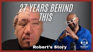 27 Years Behind Giant Scalp Keloids. Robert’s Redemption Story
