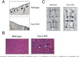 Caveolae from cell biology to animal physiology. Pdf Caveolae From Cell Biology To Animal Physiology Semantic Scholar