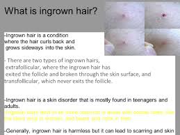 I searched online and found about acv to be used. Ingrown Hair By Sharat Nemani What Is Ingrown Hair Ingrown Hair Is A Condition Where The Hair Curls Back And Grows Sideways Into The Skin There Ppt Download