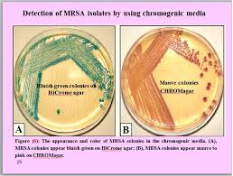 This type of bacteria is resistant to many different antibiotics. Pdf Ha Mrsa And Ca Mrsa