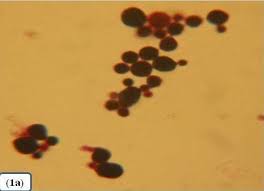 Image result for CSF Gram Stain