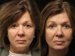 Re-introducing my rock star physician assistant