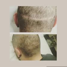 Prenota la tua visita gratuita da istituto helvetico sanders, centri tricologici leader per i trapianti con tecnica fue. Face Look Rosanna Dell Olio La Tricopigmentazione E Una Soluzione Agli Inestetismi Dovuti Alle Cicatrici Post Intervento Di Trapianto Capelli Con Tecnica Scar O Fue Tricopigmentazione Torino Rosanna Dell Olio Docente Master