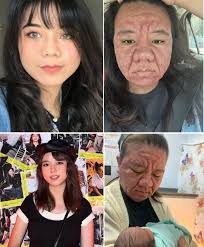 Hi everyone!!! In February of 1995 Vajanique Nige Richardson was born to a  teen mom, she was small and different. Vajanique was unique from the  beginning with a striking birthmark in the