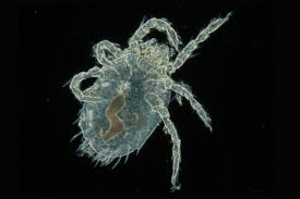 Image result for Trombicula autumnalis bites