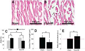 Methods For Histological Characterization Of Cryo Induced Myocardial Infarction In A Rat Model Sciencedirect