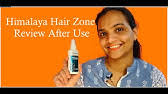 Each oil has its strength and together they reduce excessive hair fall, help in development of hair thickness, prevent premature greying and also help prevent dandruff. Himalaya Hairzone Oil Benefits Sides à¤® à¤° 9 à¤®à¤¹ à¤¨ à¤• à¤…à¤¨ à¤­à¤µ In Hindi Youtube