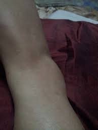 Buku lali bengkak tapi tidak sakit. Kisah Zara Mirza Si Pari Pari Kecil Buku Lali Ku Bengkak