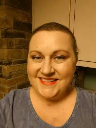 health update after operation and chemo