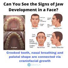 Dr Steven Lin Can You Spot The Signs Of Crooked Teeth Today We Are In An Orthodontic Epidemic It S The Biggest Health Problem On The Planet When Teeth Are Crooked It S
