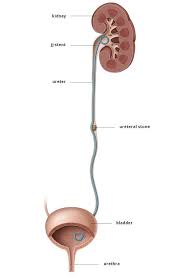 Pnl For Kidney Or Ureteral Stones Eau Patient Information Kidney Stone Kidney Stones