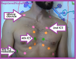 Lung Auscultation Points Sounds